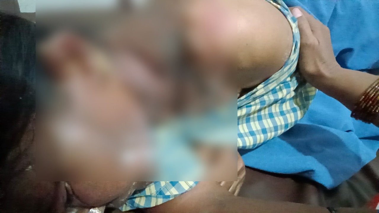 ತುಮಕೂರು || ಶಾಲೆಯಲ್ಲಿ ಬಿಸಿಯೂಟ ತಯಾರಿಸುವಾಗ ಕುಕ್ಕರ್ ಸ್ಪೋಟ