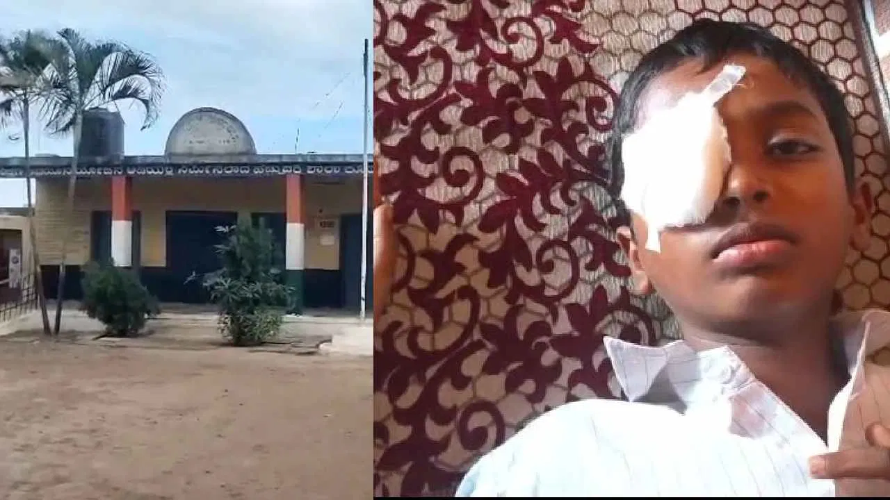 ಪೆನ್ನಿನ ವಿಚಾರಕ್ಕೆ ಗಲಾಟೆ: 1ನೇ ತರಗತಿಯ ವಿದ್ಯಾರ್ಥಿಯಿಂದ 5ನೇ ತರಗತಿಯ ವಿದ್ಯಾರ್ಥಿಗೆ ಭೀಕರ ಗಾಯ | ಕಣ್ಣು ಕಳೆದುಕೊಂಡ ಬಾಲಕ.