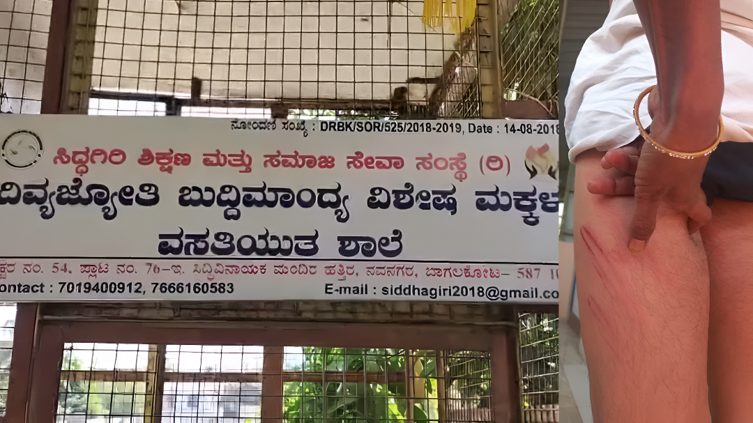 ಬುದ್ಧಿಮಾಂದ್ಯ ಬಾಲಕನ ಮೇಲೆ ಶಿಕ್ಷಕ ದಂಪತಿಯ ಕ್ರೂರ ಹ*.